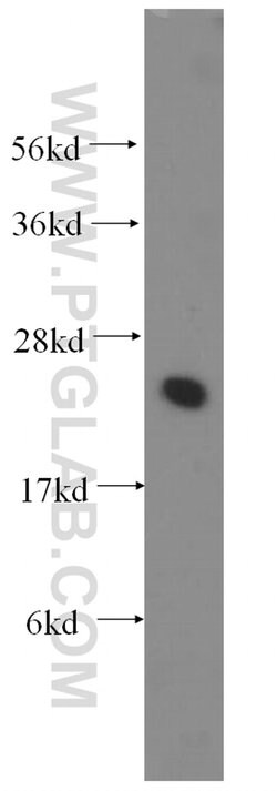 UBE2K Rabbit anti-Human, Mouse, Rat, Polyclonal, Proteintech 150 &mu;L;