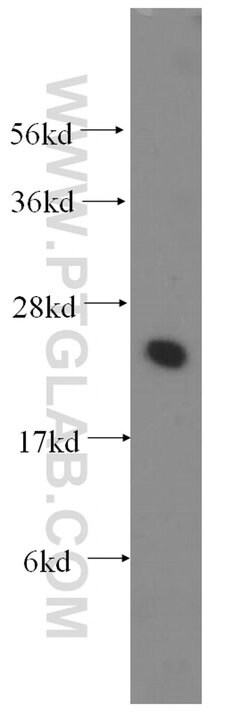 UBE2K Rabbit anti-Human, Mouse, Rat, Polyclonal, Proteintech:  