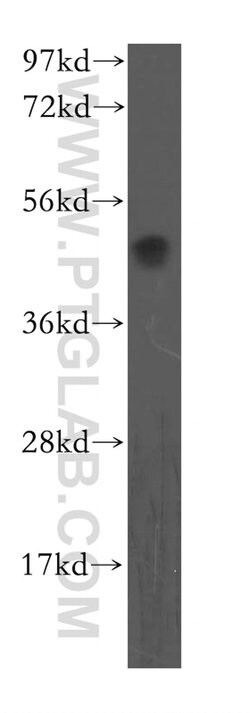 OLR1 Rabbit anti-Human, Polyclonal, Proteintech 150 &mu;L; Unconjugated:Antibodies,