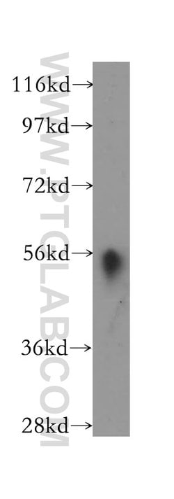 HLA-DMA Rabbit anti-Human, Mouse, Rat, Polyclonal, Proteintech:Antibodies:Primary