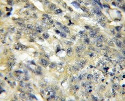 Surfactant protein D Rabbit anti-Human, Mouse, Rat, Polyclonal, Proteintech:Antibodies:Primary
