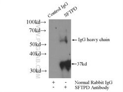 Surfactant protein D Rabbit anti-Human, Mouse, Rat, Polyclonal, Proteintech:Antibodies:Primary