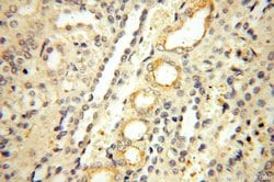 Surfactant protein D Rabbit anti-Human, Mouse, Rat, Polyclonal, Proteintech:Antibodies:Primary