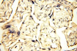 Surfactant protein D Rabbit anti-Human, Mouse, Rat, Polyclonal, Proteintech:Antibodies:Primary