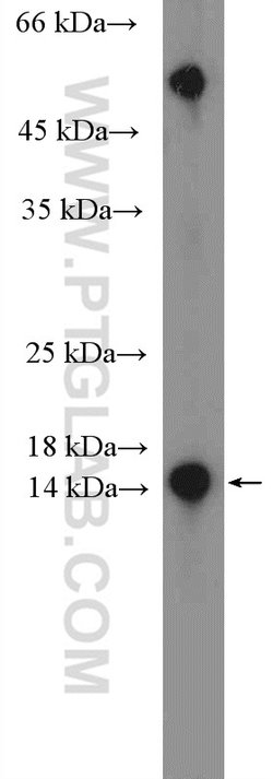 RBP5 Rabbit anti-Human, Porcine, Rat, Polyclonal, Proteintech 20 &mu;L;