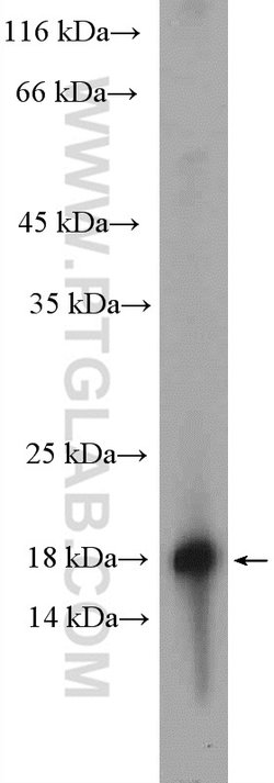 RBP5 Rabbit anti-Human, Porcine, Rat, Polyclonal, Proteintech 20 &mu;L;