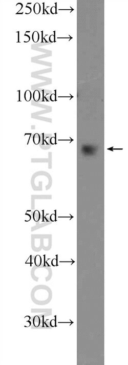 GBP2 Rabbit anti-Human, Rat, Polyclonal, Proteintech 20 &mu;L; Unconjugated:Antibodies,