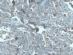 HSD17B6 Rabbit anti-Human, Mouse, Rat, Polyclonal, Proteintech:Antibodies:Primary