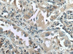 HSD17B6 Rabbit anti-Human, Mouse, Rat, Polyclonal, Proteintech:Antibodies:Primary