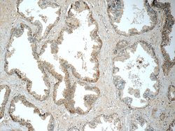 HSD17B6 Rabbit anti-Human, Mouse, Rat, Polyclonal, Proteintech:Antibodies:Primary