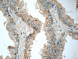 HSD17B6 Rabbit anti-Human, Mouse, Rat, Polyclonal, Proteintech:Antibodies:Primary