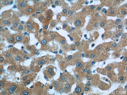 HSD17B6 Rabbit anti-Human, Mouse, Rat, Polyclonal, Proteintech:Antibodies:Primary