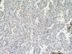 HSD17B6 Rabbit anti-Human, Mouse, Rat, Polyclonal, Proteintech:Antibodies:Primary