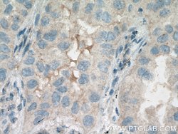HSD17B6 Rabbit anti-Human, Mouse, Rat, Polyclonal, Proteintech:Antibodies:Primary