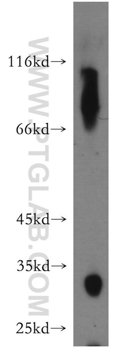 HSD17B6 Rabbit anti-Human, Mouse, Rat, Polyclonal, Proteintech:Antibodies:Primary