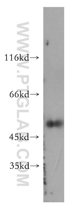 Caspase 4/p20/p10 Rabbit anti-Human, Polyclonal, Proteintech:Antibodies:Primary