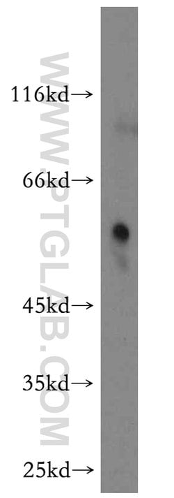 RAMP3 Rabbit anti-Human, Mouse, Polyclonal, Proteintech 150 &mu;L; Unconjugated:Antibodies,