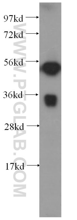 FCN3 Rabbit anti-Human, Polyclonal, Proteintech 150 &mu;L; Unconjugated:Antibodies,