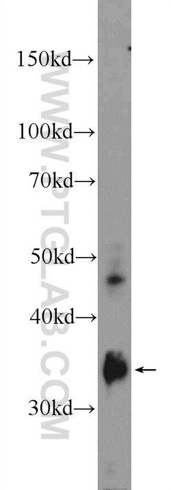 FCN3 Rabbit anti-Human, Polyclonal, Proteintech 150 &mu;L; Unconjugated:Antibodies,