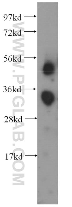 FCN3 Rabbit anti-Human, Polyclonal, Proteintech 150 &mu;L; Unconjugated:Antibodies,