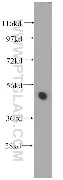 TTC4 Rabbit anti-Human, Mouse, Rat, Polyclonal, Proteintech:Antibodies:Primary