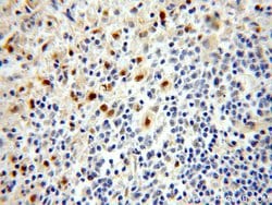 KLF4 Rabbit anti-Human, Mouse, Rat, Polyclonal, Proteintech 150 &mu;L;