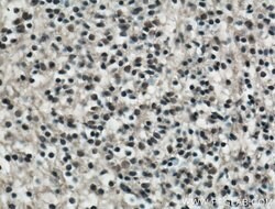 KLF4 Rabbit anti-Human, Mouse, Rat, Polyclonal, Proteintech 150 &mu;L;