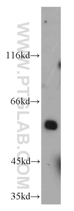 KLF4 Rabbit anti-Human, Mouse, Rat, Polyclonal, Proteintech 150 &mu;L;