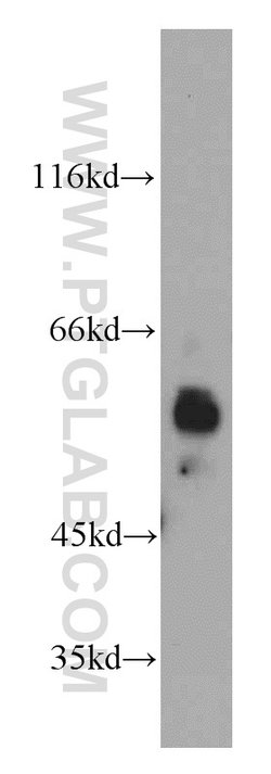 KLF4 Rabbit anti-Human, Mouse, Rat, Polyclonal, Proteintech 150 &mu;L;