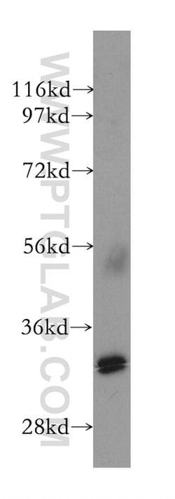 XLF Rabbit anti-Human, Polyclonal, Proteintech:Antibodies:Primary Antibodies