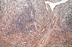 AGGF1 Rabbit anti-Human, Mouse, Rat, Polyclonal, Proteintech:Antibodies:Primary
