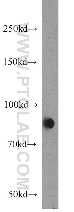 AGGF1 Rabbit anti-Human, Mouse, Rat, Polyclonal, Proteintech:Antibodies:Primary