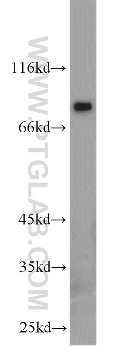 AGGF1 Rabbit anti-Human, Mouse, Rat, Polyclonal, Proteintech:Antibodies:Primary