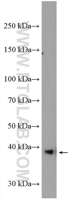 GRAP2 Rabbit anti-Human, Mouse, Rat, Polyclonal, Proteintech 150 &mu;L;