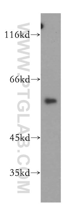 DGKE Rabbit anti-Human, Mouse, Rat, Polyclonal, Proteintech:Antibodies:Primary