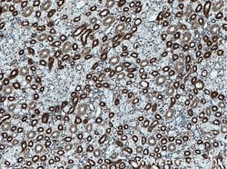 Uromodulin Rabbit anti-Human, Mouse, Rat, Polyclonal, Proteintech 20 &mu;L;