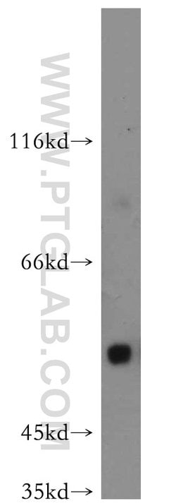 Uromodulin Rabbit anti-Human, Mouse, Rat, Polyclonal, Proteintech 20 &mu;L;