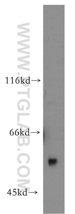 Uromodulin Rabbit anti-Human, Mouse, Rat, Polyclonal, Proteintech 20 &mu;L;