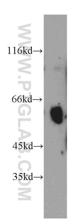 Uromodulin Rabbit anti-Human, Mouse, Rat, Polyclonal, Proteintech 20 &mu;L;
