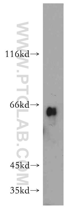 Uromodulin Rabbit anti-Human, Mouse, Rat, Polyclonal, Proteintech 20 &mu;L;
