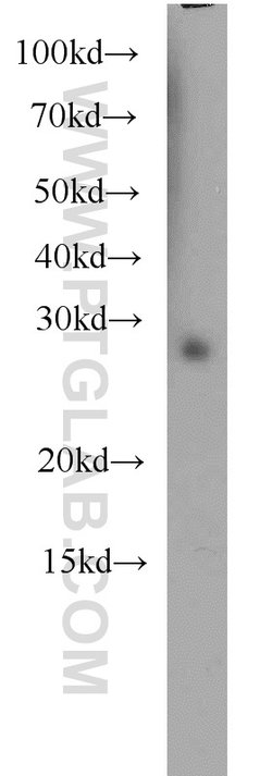 RABL3 Rabbit anti-Human, Mouse, Rat, Polyclonal, Proteintech 20 &mu;L; Unconjugated 