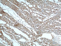 ST2 Rabbit anti-Human, Mouse, Rat, Polyclonal, Proteintech:Antibodies:Primary