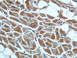ST2 Rabbit anti-Human, Mouse, Rat, Polyclonal, Proteintech:Antibodies:Primary