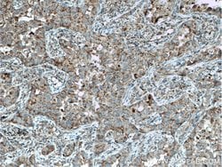 ST2 Rabbit anti-Human, Mouse, Rat, Polyclonal, Proteintech:Antibodies:Primary