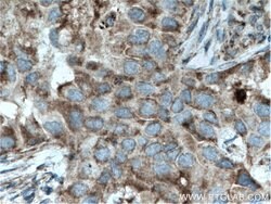 ST2 Rabbit anti-Human, Mouse, Rat, Polyclonal, Proteintech:Antibodies:Primary