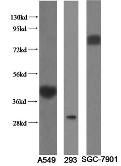ST2 Rabbit anti-Human, Mouse, Rat, Polyclonal, Proteintech:Antibodies:Primary
