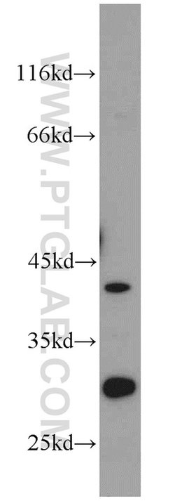 ST2 Rabbit anti-Human, Mouse, Rat, Polyclonal, Proteintech:Antibodies:Primary