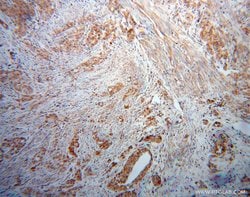 Kininogen 1 Rabbit anti-Human, Polyclonal, Proteintech:Antibodies:Primary