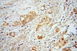 Kininogen 1 Rabbit anti-Human, Polyclonal, Proteintech:Antibodies:Primary