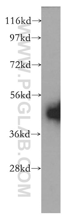 Kininogen 1 Rabbit anti-Human, Polyclonal, Proteintech:Antibodies:Primary